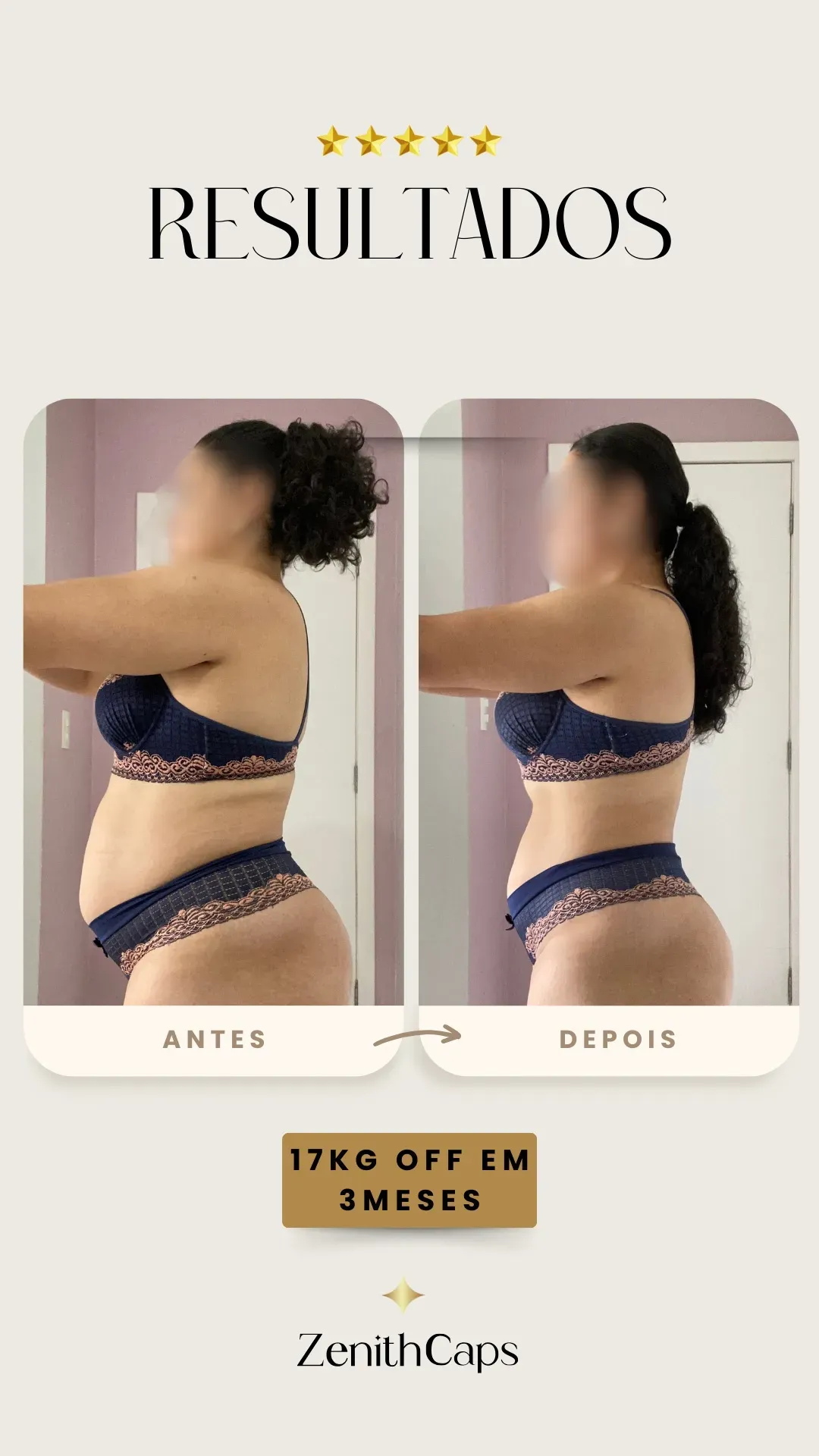 imgi_5_antes_e_depois_story_zip_17