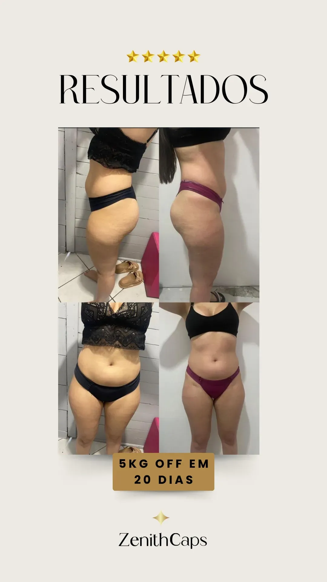 imgi_6_antes_e_depois_story_zip_21